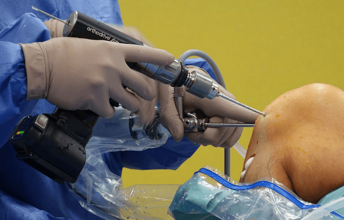 The Advantages of Modern Endoscopy Technology for Patient Safety and Comfort