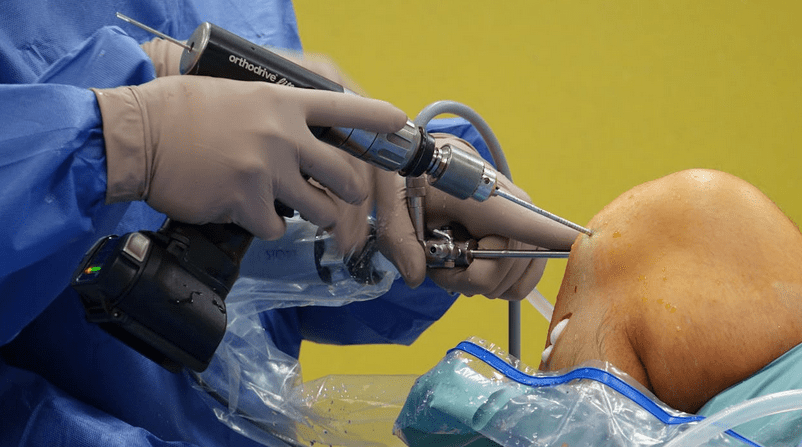 The Advantages of Modern Endoscopy Technology for Patient Safety and Comfort
