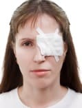 woman with one eye bandaged 